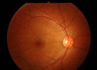 Is Your Visual perception Disintegrating houston macular pucker